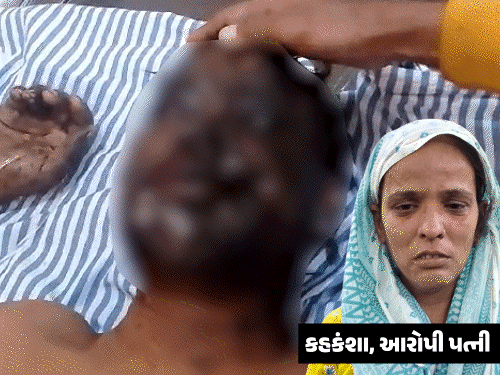 UPમાં પતિની આંખોમાં એસિડ નાખનાર પત્નીને આજીવન કેદ:સંભલ કોર્ટનો ચુકાદો, ઘરમાં પત્નીને પ્રેમી સાથે પકડી હતી; પતિએ આંખો ગુમાવી, બે બાળકો છે